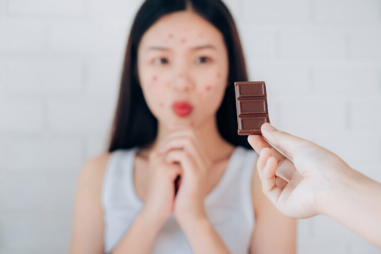 Can Diet Really Affect Acne? The Science Explained