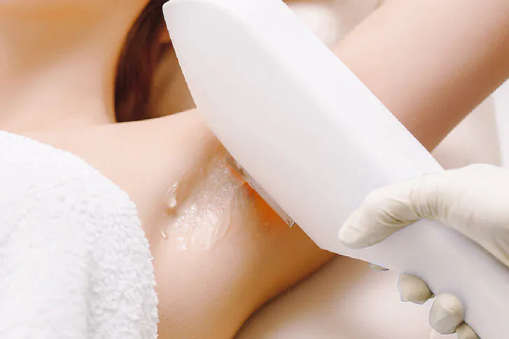 Hair Removal Service at Adonis Singapore